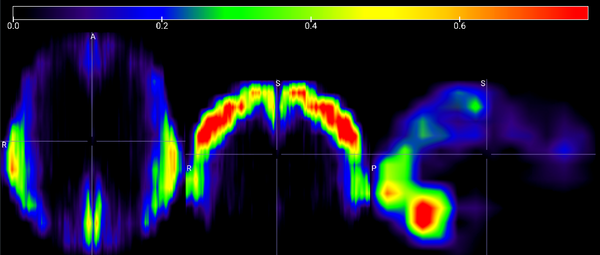 brainrotvit.png
